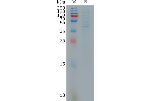 X Antigen Family, Member 1A (XAGE1A) protein (Fc Tag)