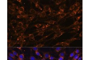 Immunofluorescence analysis of C6 cells using PREPL Polyclonal Antibody at dilution of 1:100 (40x lens). (PREPL antibody)