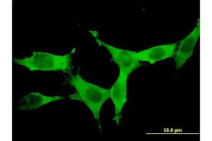 Immunofluorescence of monoclonal antibody to DCAMKL1 on NIH/3T3 cell. (DCLK1 antibody  (AA 640-729))