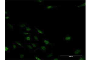 Immunofluorescence of purified MaxPab antibody to MSX2 on HeLa cell. (Msx2/Hox8 antibody  (AA 1-267))
