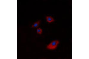 Immunofluorescent analysis of Cytokeratin 20 staining in A549 cells. (KRT20 antibody  (C-Term))