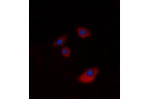 Immunofluorescent analysis of Cytokeratin 20 staining in A549 cells. (KRT20 antibody  (C-Term))
