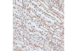 Immunohistochemistry of paraffin-embedded mouse kidney using ZNF581 antibody (ABIN6128960, ABIN6150520, ABIN6150521 and ABIN6217055) at dilution of 1:100 (40x lens). (ZNF581 antibody  (AA 1-90))