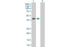 Western Blot analysis of CD58 expression in transfected 293T cell line by CD58 MaxPab polyclonal antibody. (CD58 antibody  (AA 1-250))