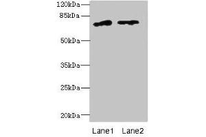 Western blot All lanes: ENOX1 antibody at 5 μg/mL Lane 1: Jurkat whole cell lysate Lane 2: Raji whole cell lysate Secondary Goat polyclonal to rabbit IgG at 1/10000 dilution Predicted band size: 74, 28 kDa Observed band size: 74 kDa