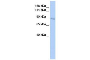 IREB2 antibody used at 1 ug/ml to detect target protein. (IREB2 antibody  (Middle Region))