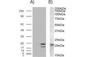 Image no. 1 for anti-GTPase NRas (NRAS) (Internal Region) antibody (ABIN375000) (GTPase NRas antibody  (Internal Region))