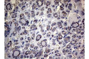 Image no. 3 for anti-Mitofusin 1 (MFN1) (AA 209-469) antibody (ABIN1491184) (MFN1 antibody  (AA 209-469))