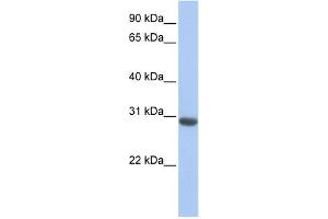WB Suggested Anti-MLF1 Antibody Titration: 0. (MLF1 antibody  (N-Term))