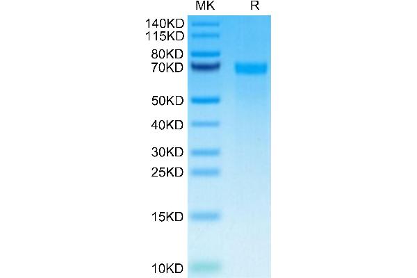 TNC Protein (AA 23-621) (His tag)