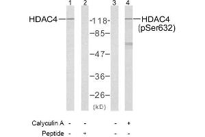 Image no. 1 for anti-Histone Deacetylase 4 (HDAC4) (pSer632) antibody (ABIN196930) (HDAC4 antibody  (pSer632))