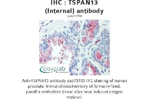 Image no. 1 for anti-Tetraspanin 13 (TSPAN13) (Internal Region) antibody (ABIN1740425) (TSPAN13 antibody  (Internal Region))