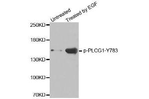Western blot analysis of extracts from HL60 cells, using phospho-PLCG1-Y783 antibody (ABIN2987485). (Phospholipase C gamma 1 antibody  (pTyr783))
