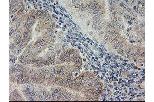 Immunohistochemistry (IHC) image for anti-ATP/GTP Binding Protein 1 (AGTPBP1) (AA 368-753) antibody (ABIN1491460) (AGTPBP1 antibody  (AA 368-753))
