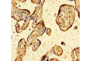 Immunohistochemistry of paraffin-embedded human placenta tissue using ABIN7176020 at dilution of 1:100 (ZBED1 antibody  (AA 1-210))