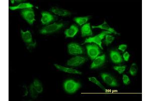 Immunofluorescence of monoclonal antibody to CAPG on HeLa cell.