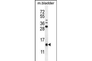 KT Antibody (C-term) (ABIN655129 and ABIN2844756) western blot analysis in mouse bladder tissue lysates (35 μg/lane). (KRTCAP2 antibody  (C-Term))