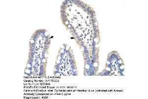 Human Intestine (METTL3 antibody  (N-Term))