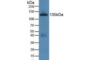Western blot analysis of Rat Uterus Tissue. (JAG1 antibody  (AA 470-834))