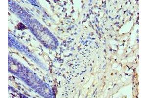Immunohistochemistry of paraffin-embedded human colon tissue using ABIN7173934 at dilution of 1:100 (TP53BP1 antibody  (AA 1758-1972))