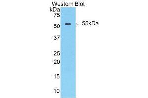 Western Blotting (WB) image for anti-Cathepsin A (CTSA) (AA 151-394) antibody (ABIN1858534) (CTSA antibody  (AA 151-394))