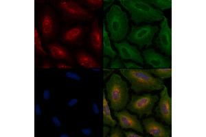 ABIN6258097 and ABIN6274226 staining  cells by IF/ICC.