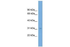 NRBF2 antibody used at 1 ug/ml to detect target protein.