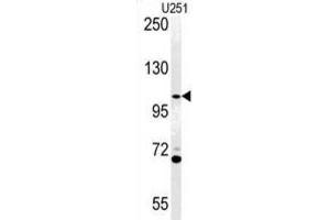 Western Blotting (WB) image for anti-ArfGAP with Coiled-Coil, Ankyrin Repeat and PH Domains 3 (Acap3) antibody (ABIN3002257)