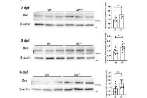 Western Blotting (WB) image for anti-Deleted in Colorectal Carcinoma (DCC) (Middle Region) antibody (ABIN2782671)