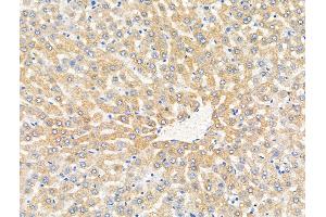 ABIN7094876 and ABIN7098928 at 1/100 staining Rat liver tissue by IHC-P.