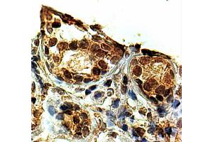 ABIN2563509 (2µg/ml) staining of paraffin embedded Human Breast. (KAP1 antibody  (C-Term))