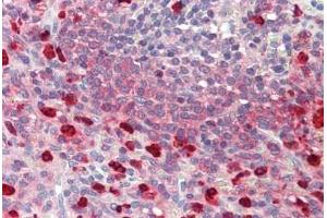 Human Spleen: Formalin-Fixed, Paraffin-Embedded (FFPE) (CDKN2D antibody  (AA 15-43))