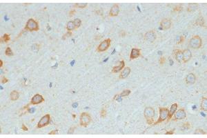 Immunohistochemistry of paraffin-embedded Rat brain using DDX3X Polyclonal Antibody at dilution of 1:100 (40x lens).