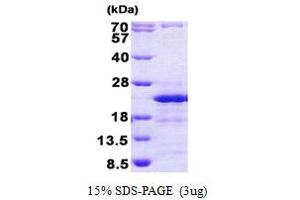 SDS-PAGE (SDS) image for HLA-DR-gamma (CD74) (AA 73-232) protein (His tag) (ABIN5852980) (CD74 Protein (AA 73-232) (His tag))