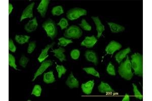 Immunofluorescence of monoclonal antibody to ANXA2 on HeLa cell. (Annexin A2 antibody  (AA 19-357))