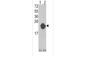 Western blot analysis of IL1RN (arrow) using rabbit polyclonal IL1RN Antibody (Center) (ABIN390396 and ABIN2840788). (IL1RN antibody  (AA 100-129))