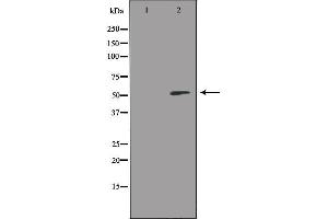 Western blot analysis of extracts from HeLa cells, using RSAD1 antibody. (RSAD1 antibody  (Internal Region))