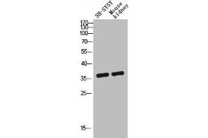 G Protein-Coupled Receptor 119 Antikörper  (Internal Region)