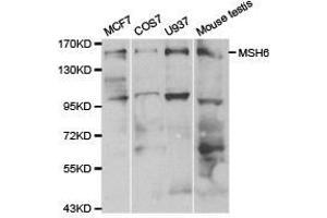 Western Blotting (WB) image for anti-MutS Homolog 6 (E. Coli) (MSH6) antibody (ABIN1873753) (MSH6 antibody)
