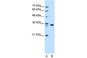 Western Blot showing ARGFX antibody used at a concentration of 1-2 ug/ml to detect its target protein.