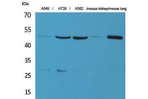 Western Blotting (WB) image for anti-GDP Dissociation Inhibitor 2 (GDI2) (C-Term) antibody (ABIN3187833) (GDI2 antibody  (C-Term))