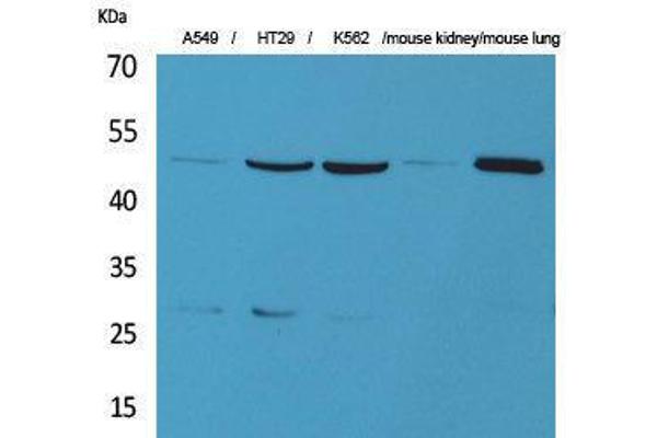 GDI2 antibody  (C-Term)