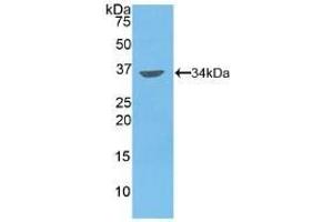 Detection of Recombinant MMP7, Human using Polyclonal Antibody to Matrix Metalloproteinase 7 (MMP7) (MMP7 antibody  (AA 1-267))