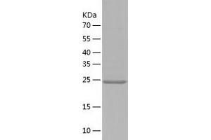 Western Blotting (WB) image for Elastase 3B, Pancreatic (ELA3B) (AA 28-269) protein (His tag) (ABIN7288702) (Elastase 3B Protein (AA 28-269) (His tag))