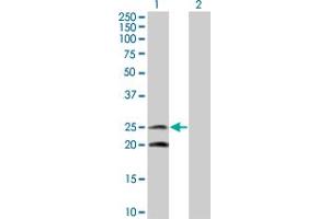 Western Blot analysis of IL6 expression in transfected 293T cell line by IL6 monoclonal antibody (M08), clone 2C5. (IL-6 antibody  (AA 29-212))