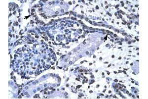 FOXG1A antibody was used for immunohistochemistry at a concentration of 4-8 ug/ml to stain Epithelial cells of renal tubule (arrows) in Human Kidney. (FOXG1 antibody  (N-Term))