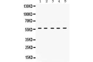 Anti- Lck Picoband antibody, Western blottingAll lanes: Anti Lck  at 0. (LCK antibody  (C-Term))