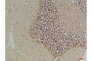 Immunohistochemistry (IHC) analysis of paraffin-embedded Rat Brain Tissue using GABA Transporter 1 Rabbit Polyclonal Antibody diluted at 1:200. (SLC6A1 antibody)
