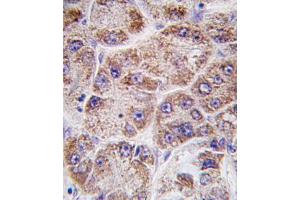 Immunohistochemistry (IHC) image for anti-Farnesyl Diphosphate Synthase (FDPS) antibody (ABIN3001523)
