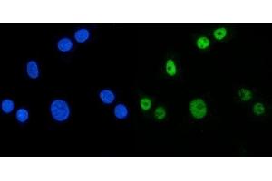 IF analysis of MBNL1 using anti-MBNL1 antibody (ABIN7602608).